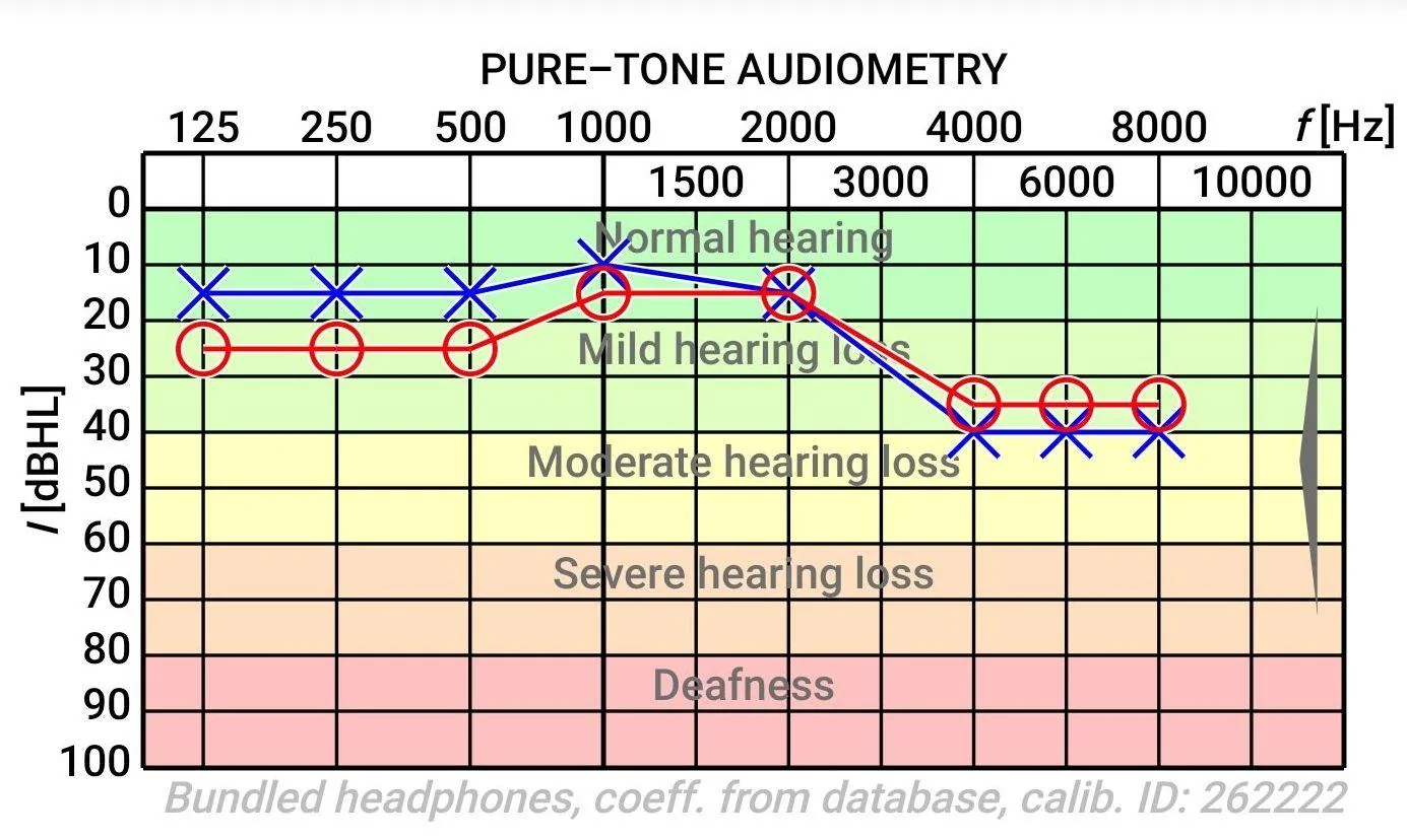 hearing-test-jpg.webp