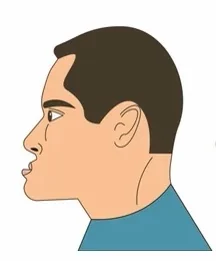 mesial-distral-bite-man-malocclusion-260nw-1266839704.webp